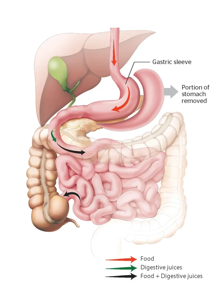 tirzepatide appetite suppression side effects What's a normal amount of appetite suppression? : r/tirzepatidecompound